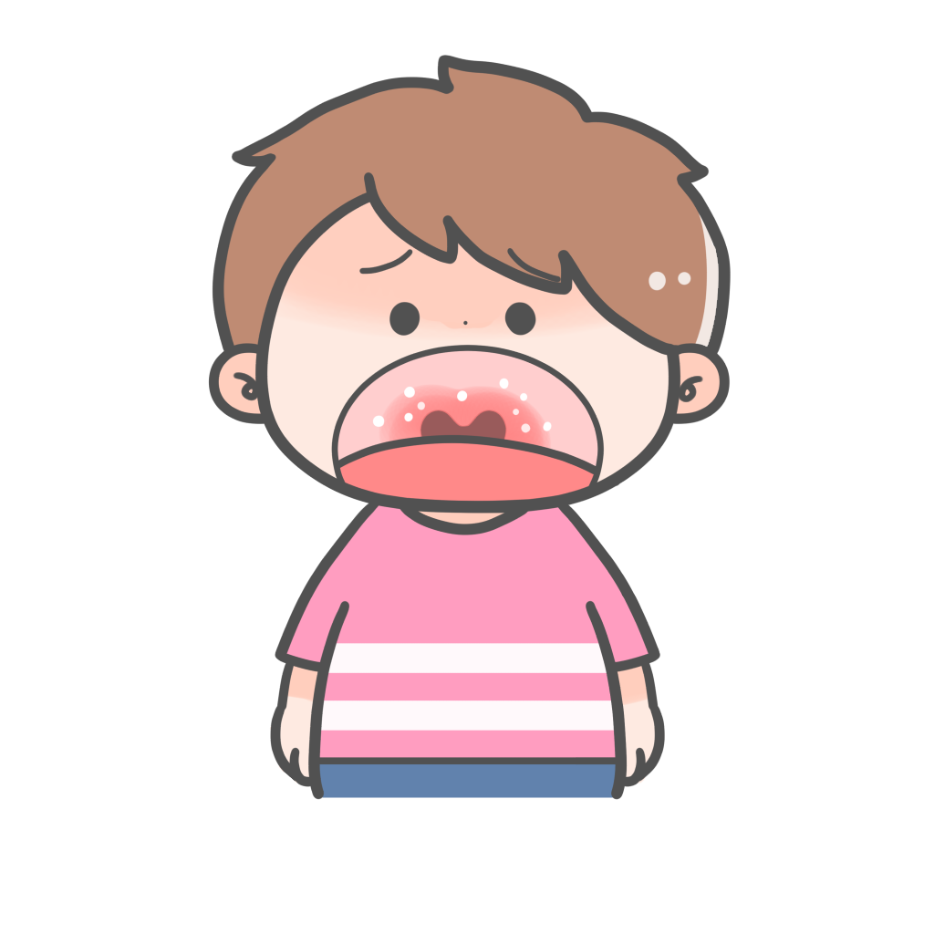 ヘルパンギーナの症状のイラスト